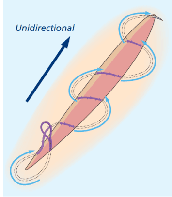 barbed sutures